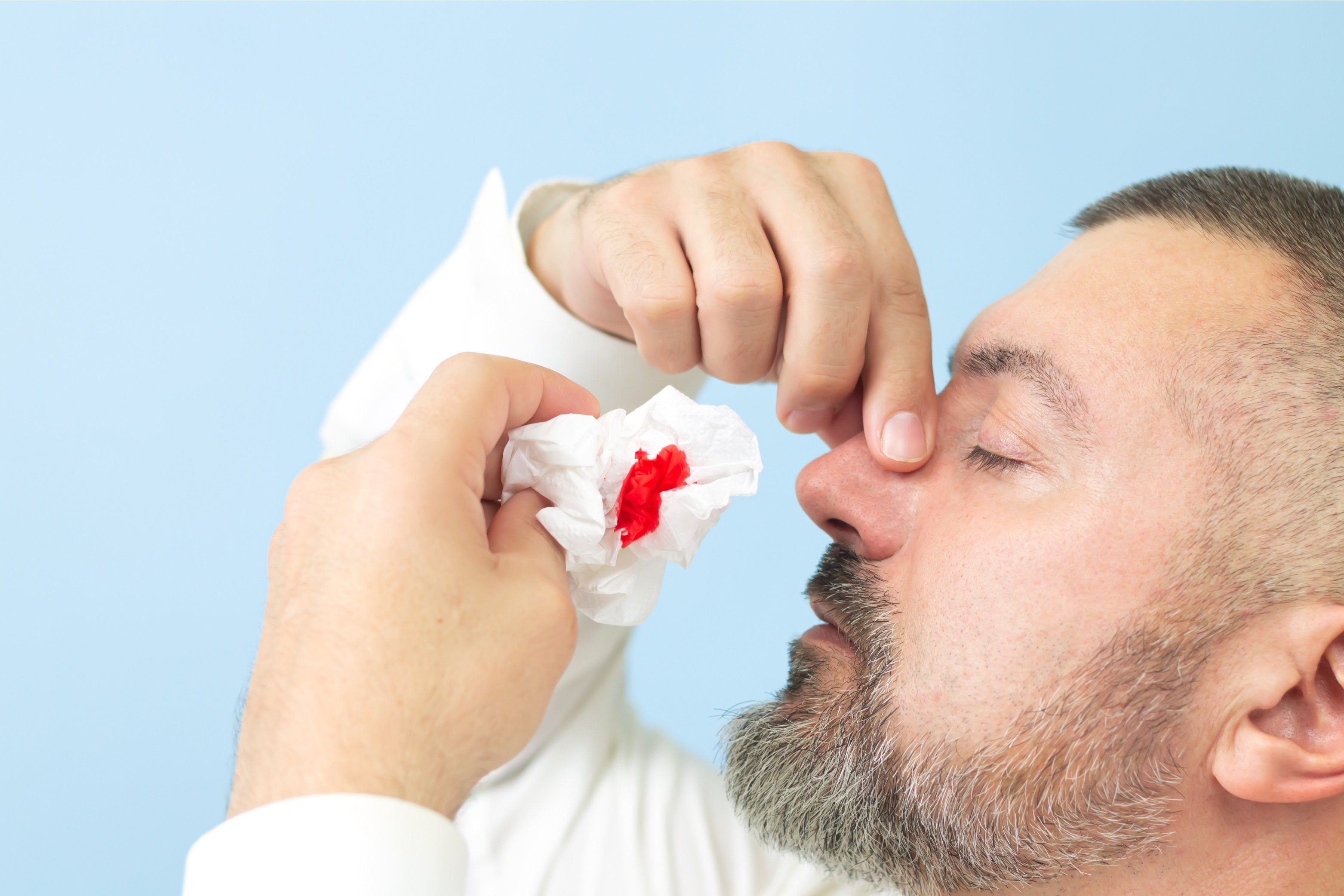 Cocaine nose can initially manifest as a nosebleed, Avenues Recovery warns.