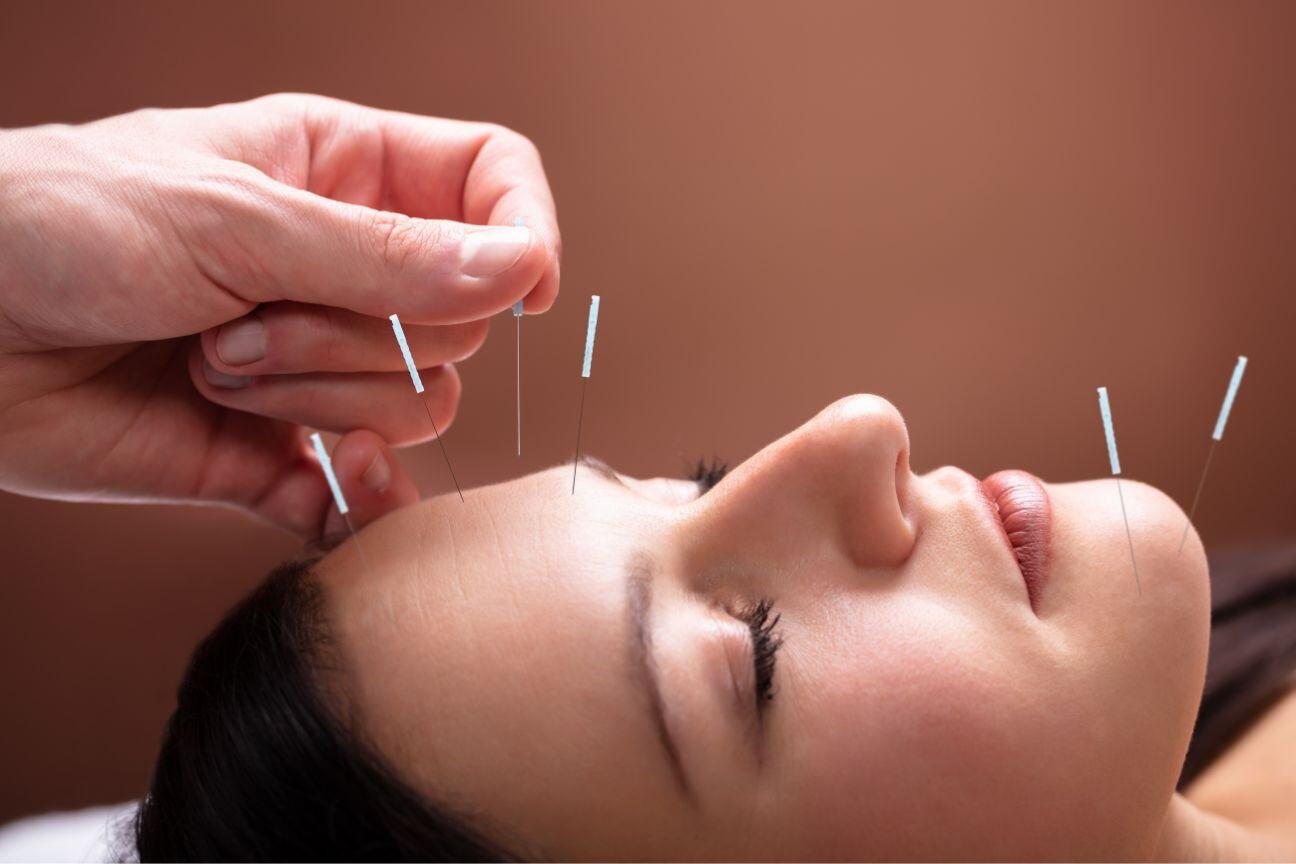 Avenues Recovery finds that acupuncture is becoming an increasingly popular form of natural pain relief. 